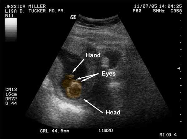 An overhead view of the baby. You can see the eyes nose and hand.
