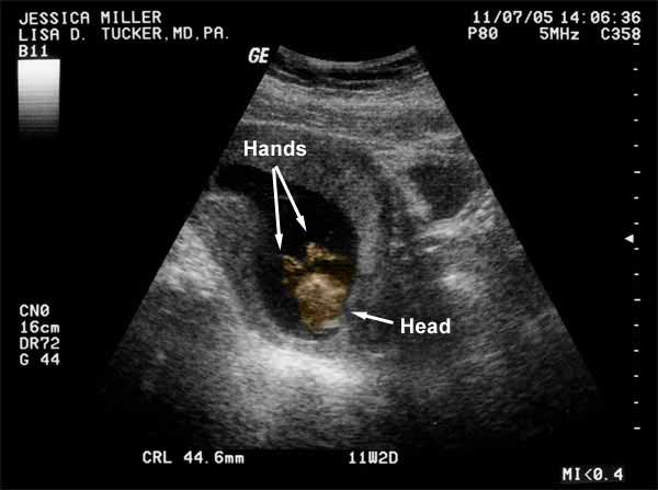 An overhead view of the head and both hands.