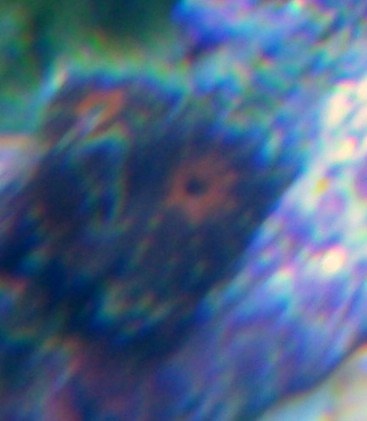 acan2.jpg